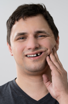 Man with missing tooth holding his cheek in pain