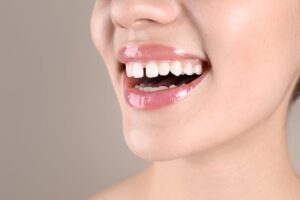 Close-up of woman's smile with gap between the front teeth